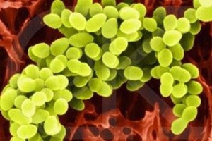 金黄色葡萄球菌(Staphylococcus aureus)