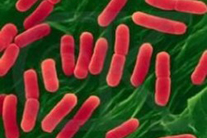 出血性大肠杆菌O:157(E.coli O157:H7)