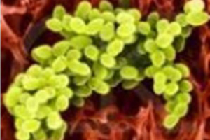 单核细胞增生李斯特菌（Listeria monocytogenes）多克隆抗体
