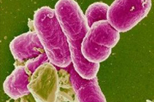 志贺氏菌(Shigella spp.)多克隆抗体