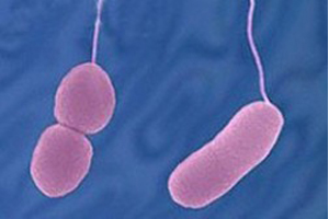 副溶血性弧菌（Vibrio parahaemolyticus）多克隆抗体