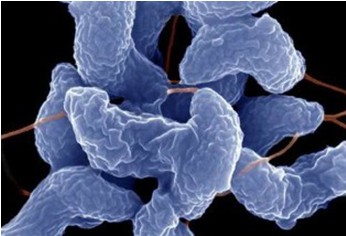 空肠弯曲菌(Campylobacter jejuni enteritis) 多克隆抗体