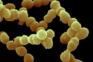 乙型溶血性链球菌（Streptococcus Hemolyticsβ）多克隆抗体