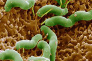 幽门螺旋杆菌（Helicobacter Pylor）多克隆抗体